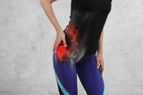 Women's Sciatic Hip Brace for Sciatica Nerve and SI Pain Relief